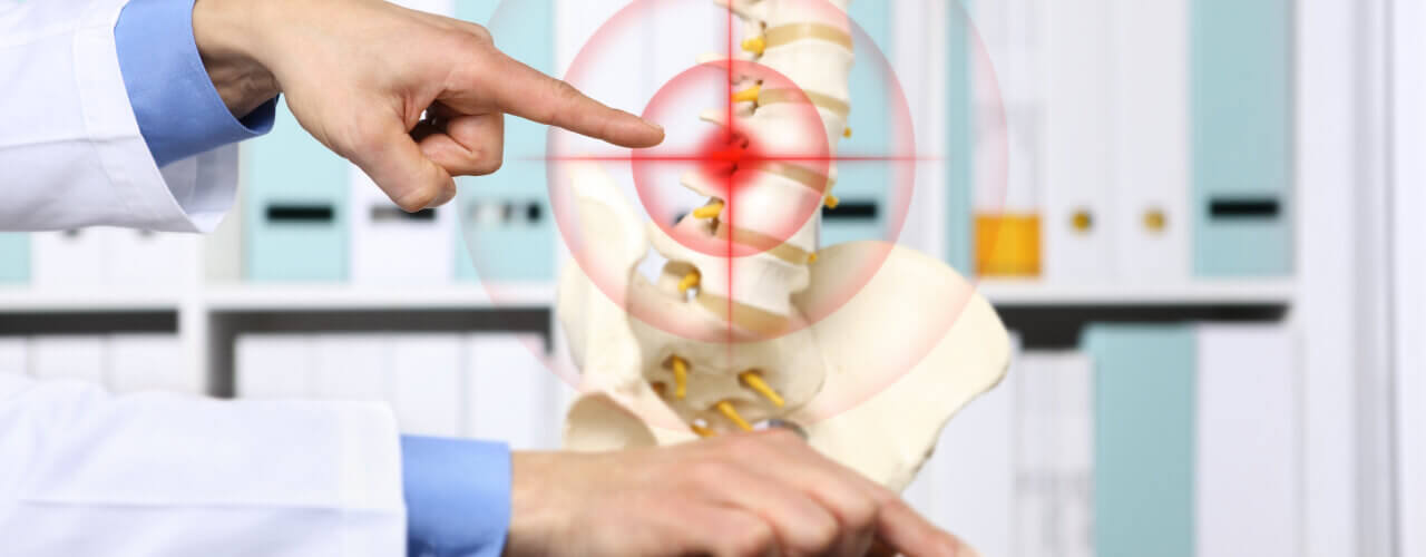 back-pain-is-commonly-caused-by-herniated-discs---do-you-know-where-your-pain-is-coming-from