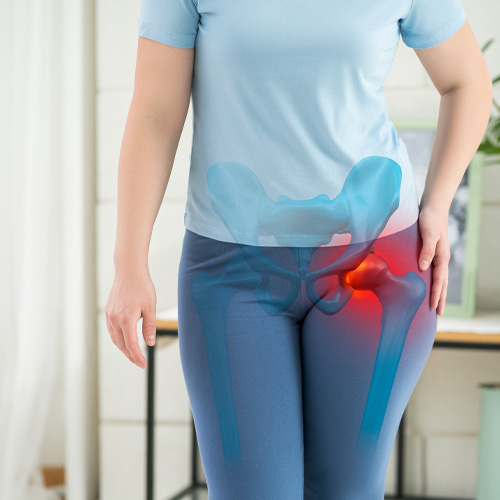 How Physical Therapy Tackles Hip Pain