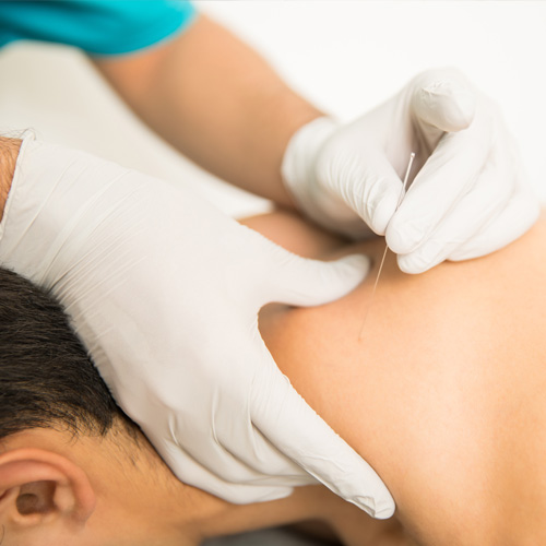 Finding Relief from Pain One Needle At a Time